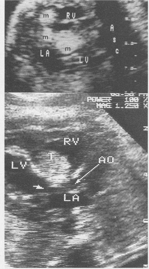 https://cdn.ncbi.nlm.nih.gov/pmc/blobs/2389/1011341/99760ac0fb8c/westjmed00073-0064-a.jpg