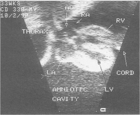 https://cdn.ncbi.nlm.nih.gov/pmc/blobs/2389/1011341/fd78c1a6bb7a/westjmed00073-0063-c.jpg