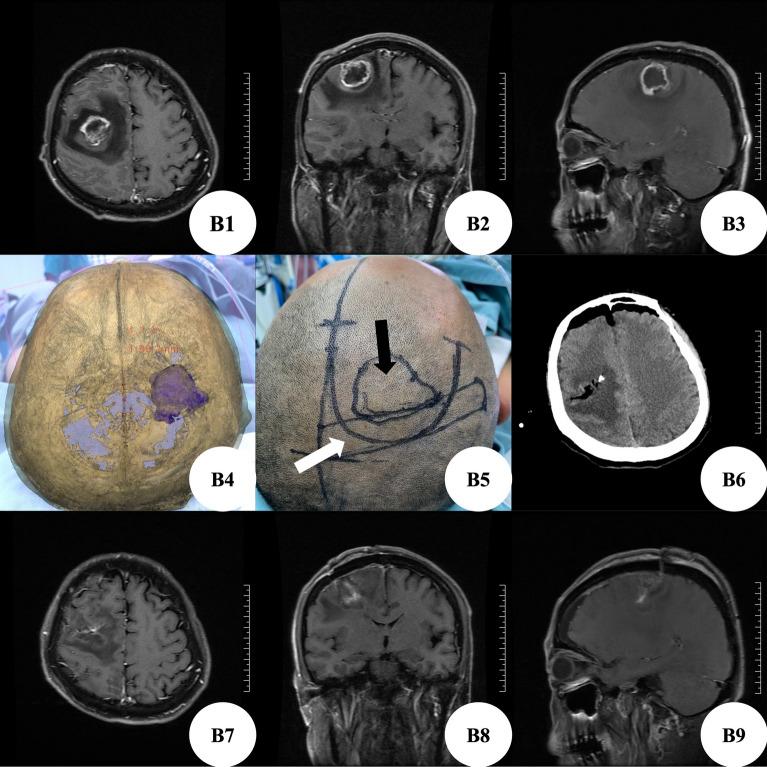 https://cdn.ncbi.nlm.nih.gov/pmc/blobs/2389/9649692/7dc7d802a4e3/41598_2022_22549_Fig2_HTML.jpg