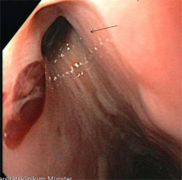 https://cdn.ncbi.nlm.nih.gov/pmc/blobs/238b/5856677/bc3db42a51b2/gr2.jpg