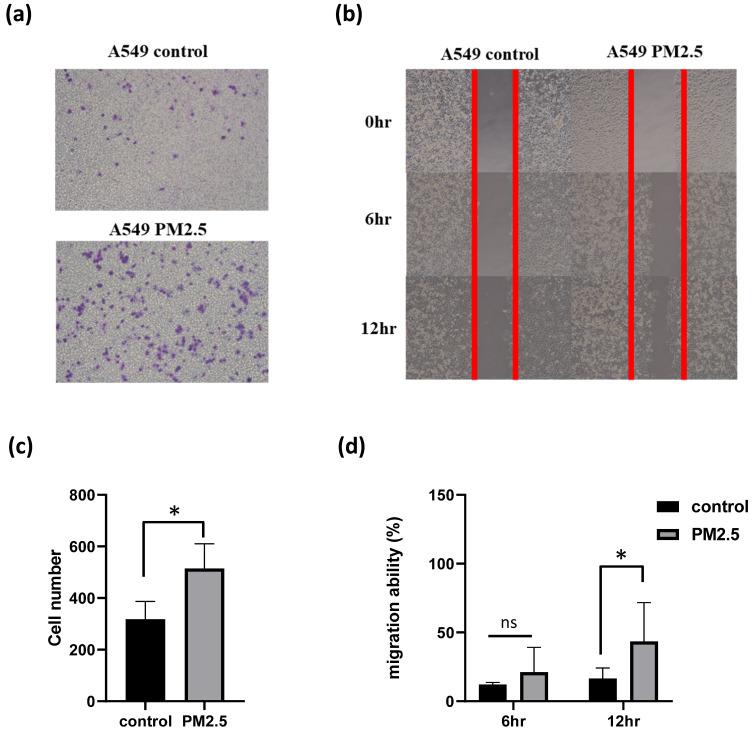 https://cdn.ncbi.nlm.nih.gov/pmc/blobs/2390/11103396/b737aceb1a6d/ijmsv21p1117g002.jpg