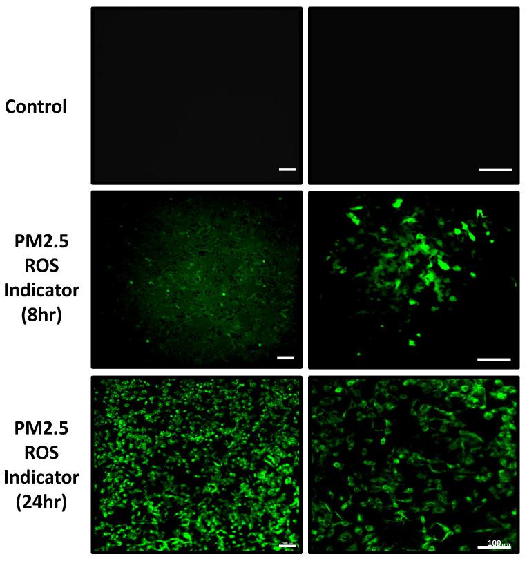 https://cdn.ncbi.nlm.nih.gov/pmc/blobs/2390/11103396/fbf78c78f041/ijmsv21p1117g006.jpg
