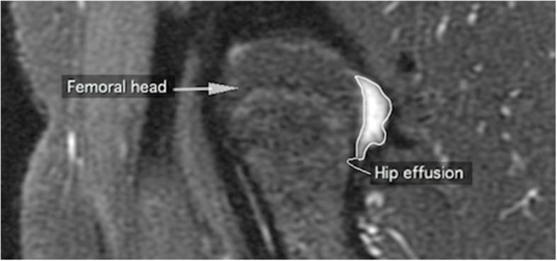 https://cdn.ncbi.nlm.nih.gov/pmc/blobs/2391/7419183/11b5df43ff5c/12891_2020_3532_Fig1_HTML.jpg