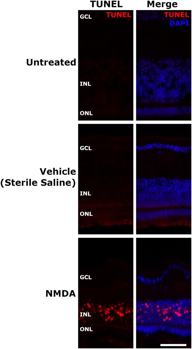 https://cdn.ncbi.nlm.nih.gov/pmc/blobs/239b/8423281/8d79b2b93021/pone.0257148.g003.jpg