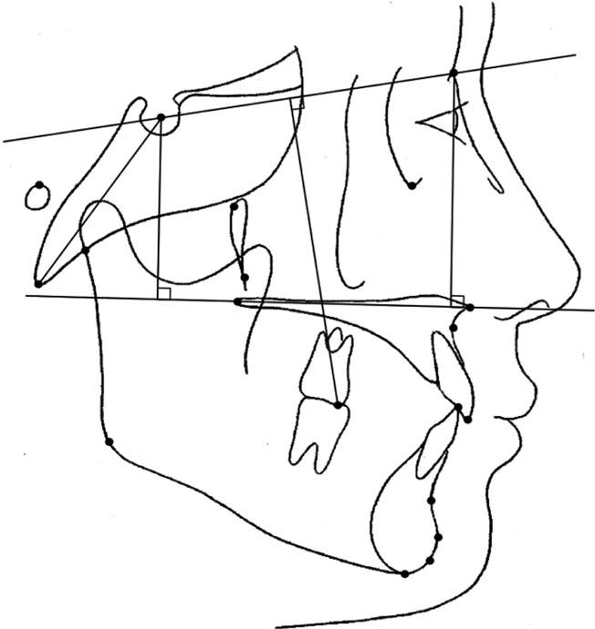 https://cdn.ncbi.nlm.nih.gov/pmc/blobs/239c/7837800/d9c88b119842/kjod-51-1-15-f3.jpg