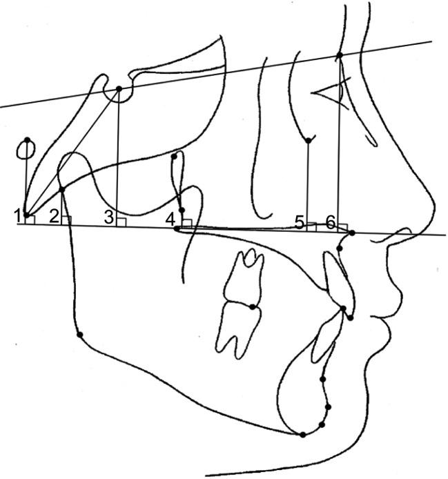 https://cdn.ncbi.nlm.nih.gov/pmc/blobs/239c/7837800/e2e337a4d9e8/kjod-51-1-15-f2.jpg