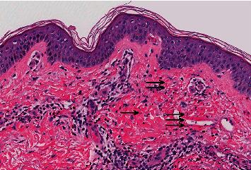 https://cdn.ncbi.nlm.nih.gov/pmc/blobs/239c/8203330/6a3aab99dd38/CRIID2021-9932425.002.jpg