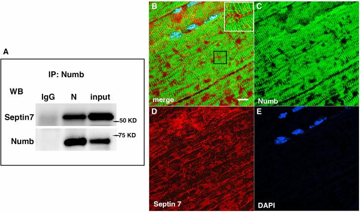 https://cdn.ncbi.nlm.nih.gov/pmc/blobs/239d/11065422/25caa53767c8/elife-89424-fig6.jpg