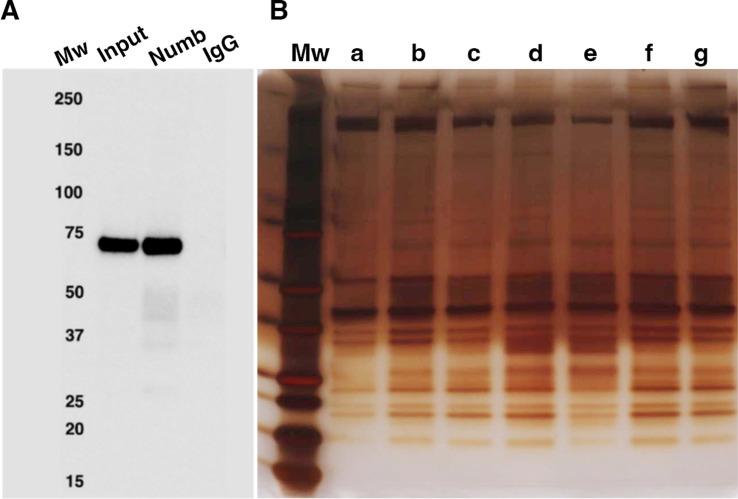 https://cdn.ncbi.nlm.nih.gov/pmc/blobs/239d/11065422/42d1945ff5ce/elife-89424-fig5.jpg
