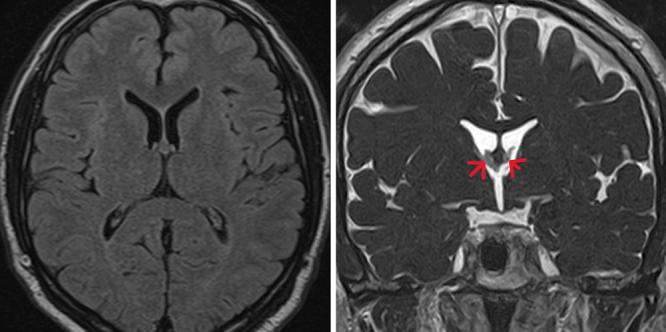 https://cdn.ncbi.nlm.nih.gov/pmc/blobs/23ac/11670133/6cfcfc19c2cc/CASE24498_figure_3.jpg