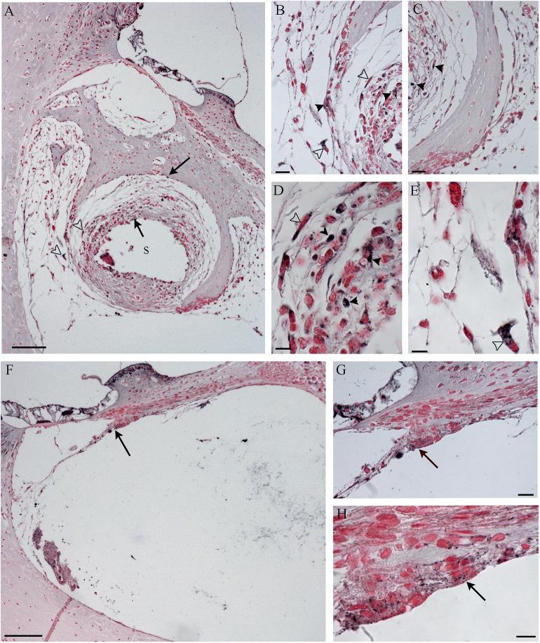 https://cdn.ncbi.nlm.nih.gov/pmc/blobs/23af/7240074/926aac372516/fneur-11-00341-g0010.jpg