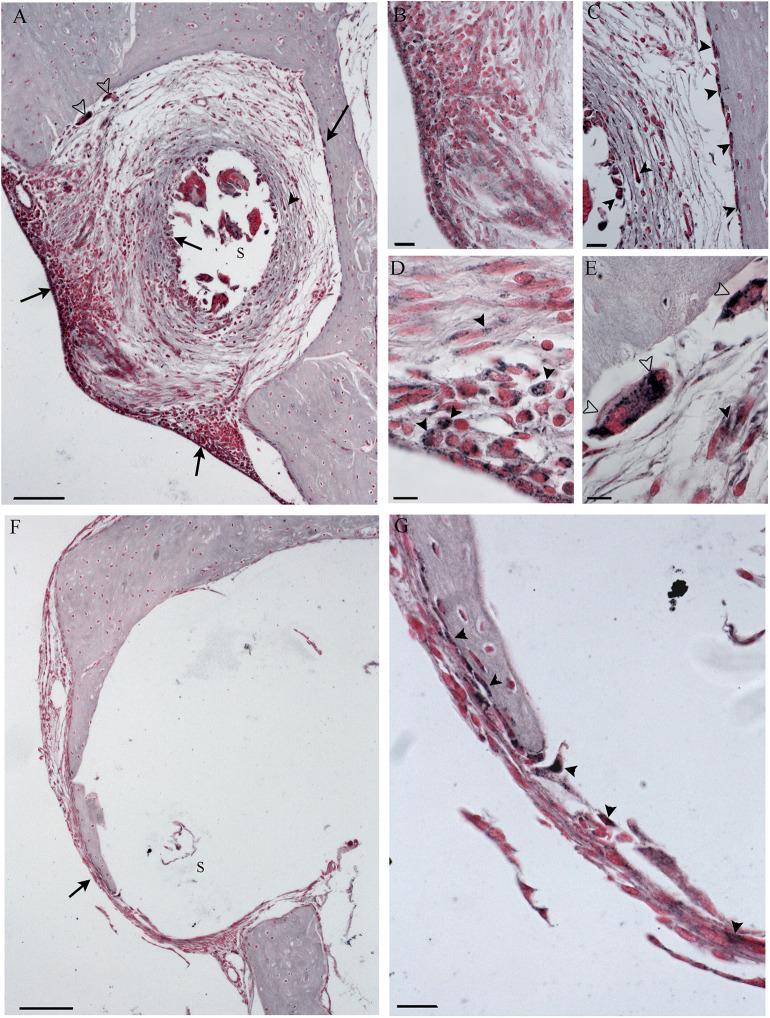 https://cdn.ncbi.nlm.nih.gov/pmc/blobs/23af/7240074/9528ec949b3b/fneur-11-00341-g0009.jpg