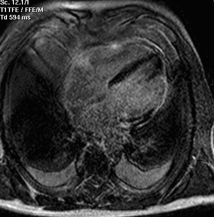 https://cdn.ncbi.nlm.nih.gov/pmc/blobs/23b6/2147020/53586aeacc83/1752-1947-1-120-3.jpg
