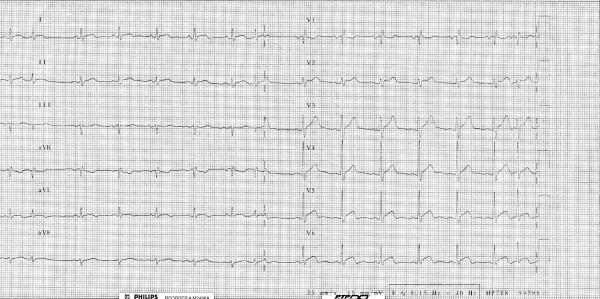 https://cdn.ncbi.nlm.nih.gov/pmc/blobs/23b6/2147020/e1e04f66ed41/1752-1947-1-120-1.jpg