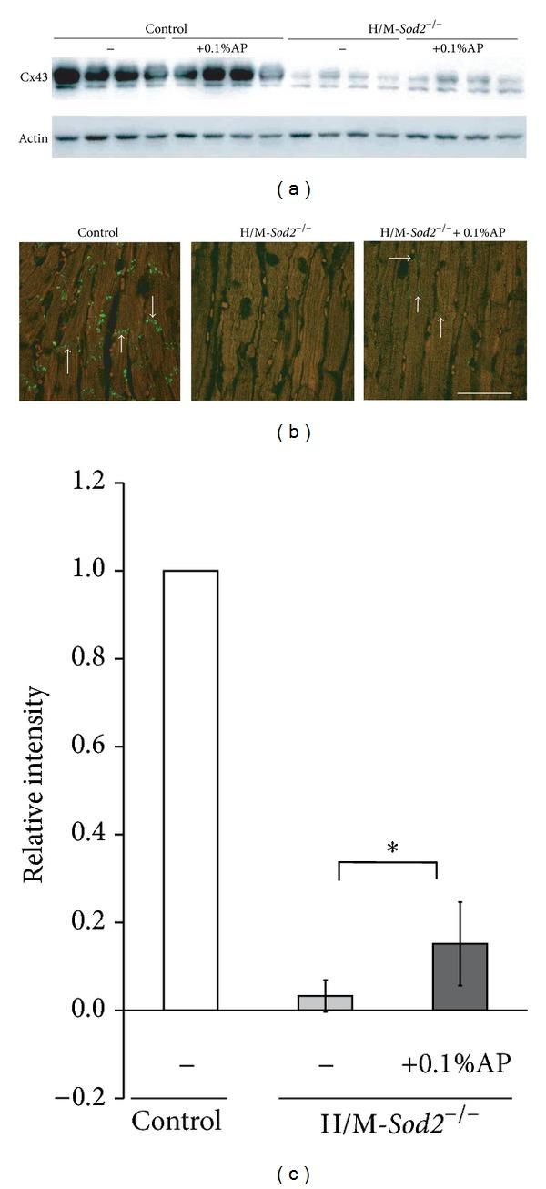 https://cdn.ncbi.nlm.nih.gov/pmc/blobs/23b7/3977505/db7a78e72cb8/BMRI2014-704291.006.jpg