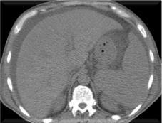 https://cdn.ncbi.nlm.nih.gov/pmc/blobs/23b7/6346872/952284a5a4ff/545_Fig1.jpg