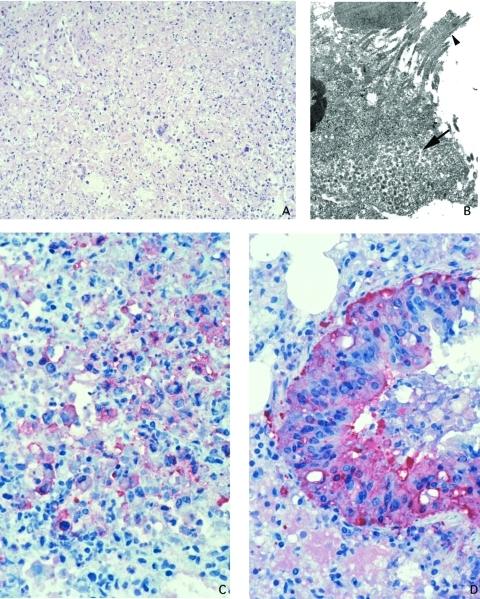https://cdn.ncbi.nlm.nih.gov/pmc/blobs/23ba/3322777/3585f2478722/03-0878-F3.jpg