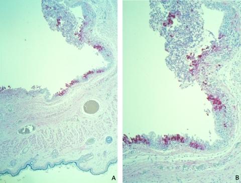 https://cdn.ncbi.nlm.nih.gov/pmc/blobs/23ba/3322777/a893e07c2db2/03-0878-F1.jpg