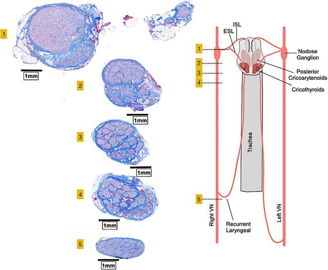 https://cdn.ncbi.nlm.nih.gov/pmc/blobs/23bc/9021417/37897d458007/fcvm-09-866957-g002.jpg