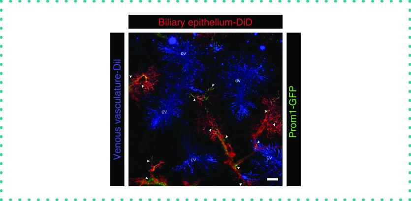 https://cdn.ncbi.nlm.nih.gov/pmc/blobs/23be/7983039/a050e2cad475/btn-70-72-g6.jpg