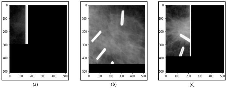 https://cdn.ncbi.nlm.nih.gov/pmc/blobs/23bf/9687367/f09f7ce0abf3/biomedicines-10-02971-g004.jpg