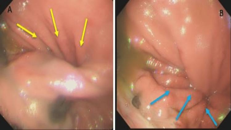 https://cdn.ncbi.nlm.nih.gov/pmc/blobs/23c3/9282863/11c4c1d6fe3c/cureus-0014-00000026862-i03.jpg