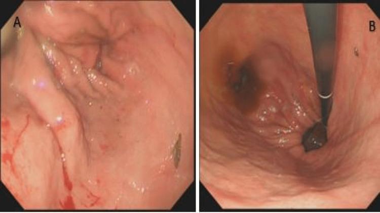 https://cdn.ncbi.nlm.nih.gov/pmc/blobs/23c3/9282863/3b1acd141b89/cureus-0014-00000026862-i05.jpg