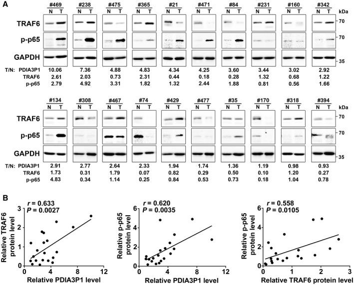 https://cdn.ncbi.nlm.nih.gov/pmc/blobs/23c6/7318625/b7ecdd63ea76/HEP-71-1660-g007.jpg