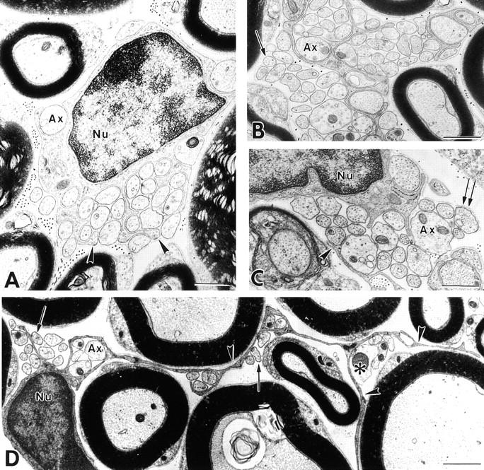 https://cdn.ncbi.nlm.nih.gov/pmc/blobs/23c7/2169489/899e0ba71635/JCB9906048.f2.jpg