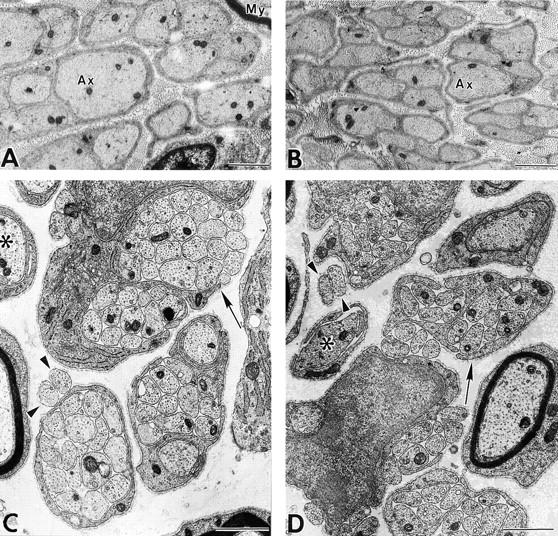 https://cdn.ncbi.nlm.nih.gov/pmc/blobs/23c7/2169489/8df2dbbda10f/JCB9906048.f3.jpg