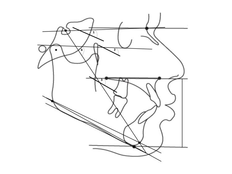 https://cdn.ncbi.nlm.nih.gov/pmc/blobs/23c9/10978819/b6b435ce4cfb/cureus-0016-00000055101-i02.jpg
