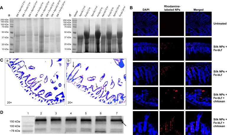 https://cdn.ncbi.nlm.nih.gov/pmc/blobs/23c9/4694672/6232eaf888a6/ijn-11-025Fig4.jpg