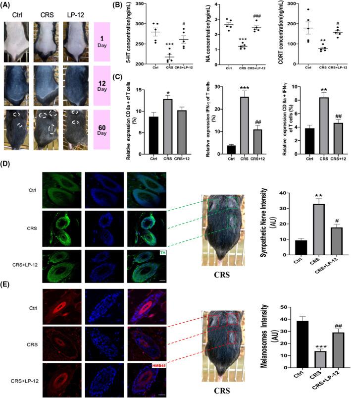 https://cdn.ncbi.nlm.nih.gov/pmc/blobs/23ce/11977531/2be5956acd1d/FSB2-37-e22893-g003.jpg