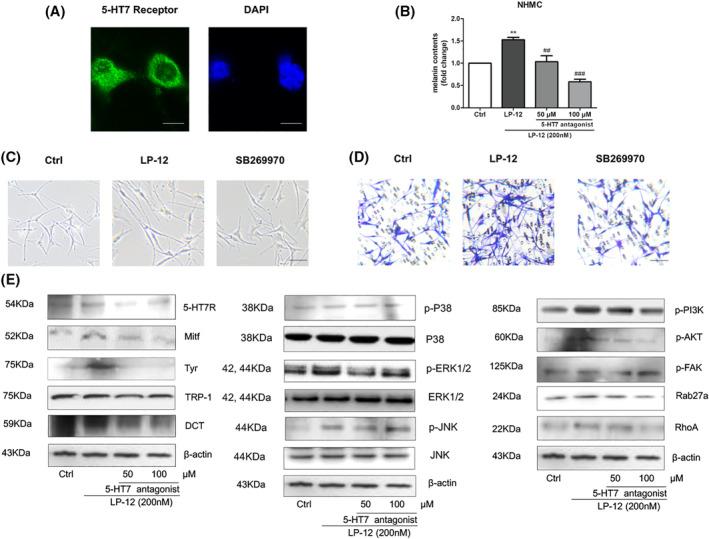 https://cdn.ncbi.nlm.nih.gov/pmc/blobs/23ce/11977531/ef66c763f22e/FSB2-37-e22893-g007.jpg