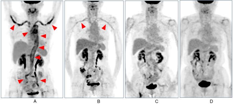 https://cdn.ncbi.nlm.nih.gov/pmc/blobs/23d0/10744572/a45b7f2416ab/medicina-59-02127-g002.jpg