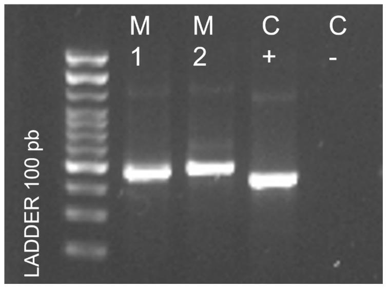 https://cdn.ncbi.nlm.nih.gov/pmc/blobs/23d6/10538155/7e5285dc3bdc/pathogens-12-01112-g002.jpg