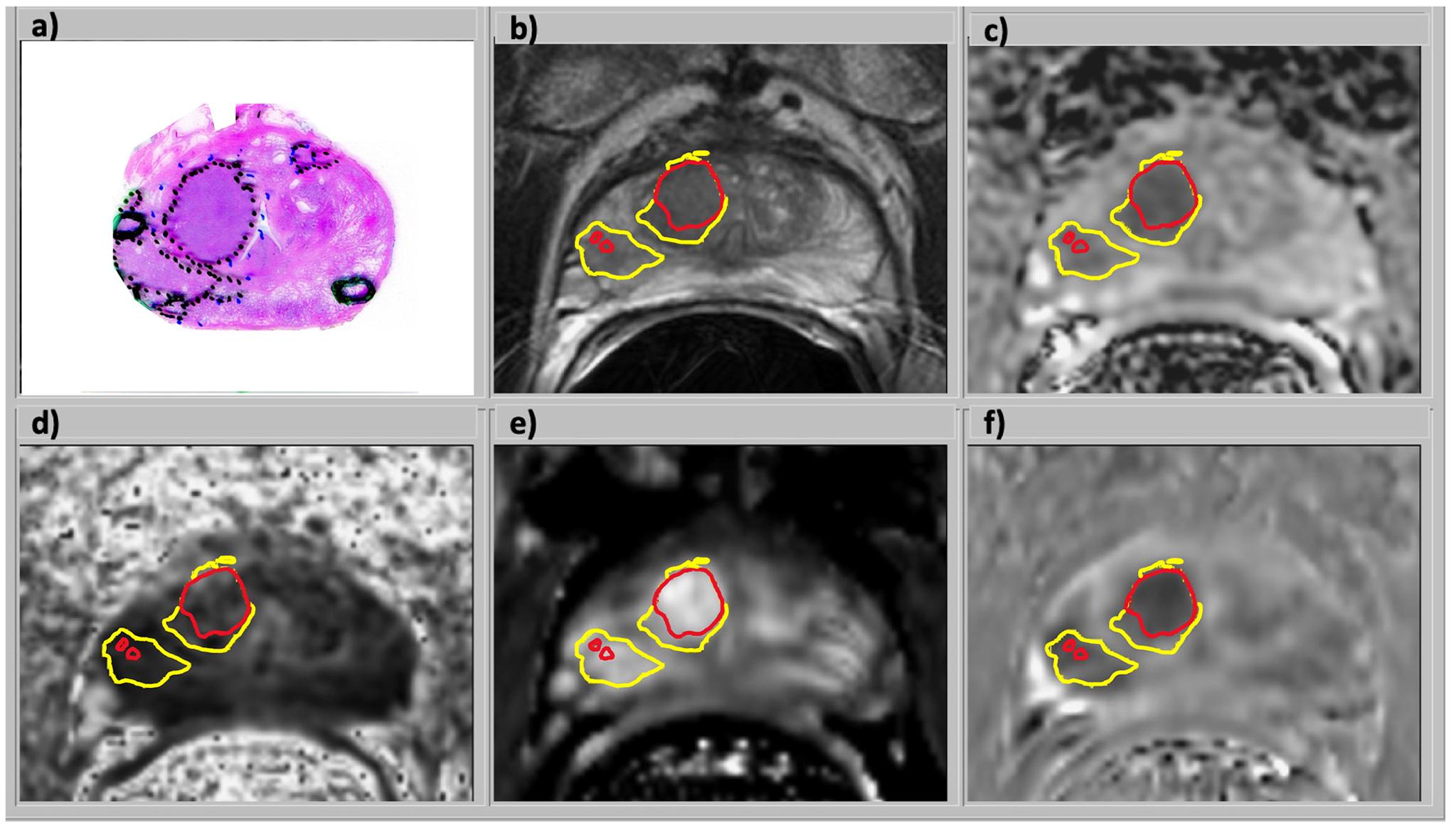 https://cdn.ncbi.nlm.nih.gov/pmc/blobs/23e3/11229728/ec533a18ddb3/nihms-2004256-f0003.jpg