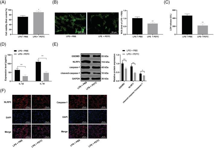 https://cdn.ncbi.nlm.nih.gov/pmc/blobs/23e4/9065873/622f6903769d/EHF2-9-1689-g003.jpg