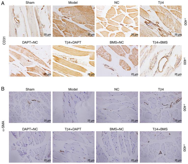 https://cdn.ncbi.nlm.nih.gov/pmc/blobs/23ed/7447324/68a8d57881b0/IJMM-46-04-1347-g05.jpg