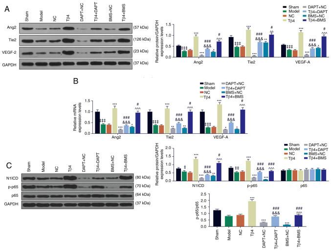 https://cdn.ncbi.nlm.nih.gov/pmc/blobs/23ed/7447324/ca2fa7a93ce8/IJMM-46-04-1347-g06.jpg