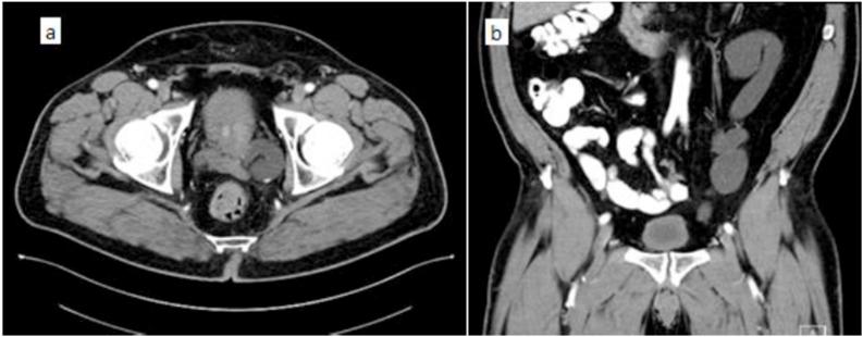 https://cdn.ncbi.nlm.nih.gov/pmc/blobs/23ef/7808921/9cccd298b197/gr1.jpg