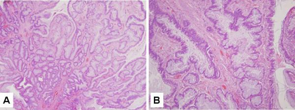 https://cdn.ncbi.nlm.nih.gov/pmc/blobs/23f0/1764424/9a7b79176f63/1476-4598-5-73-2.jpg