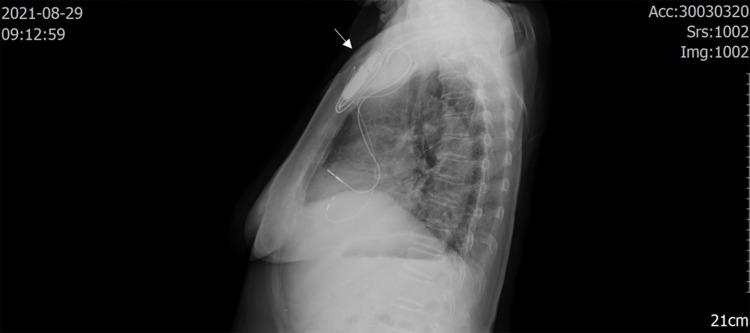 https://cdn.ncbi.nlm.nih.gov/pmc/blobs/23f4/9188390/3767210c2a41/IDR-15-2915-g0002.jpg