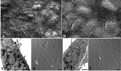https://cdn.ncbi.nlm.nih.gov/pmc/blobs/23f7/5617901/b2984567a1d5/ejh-61-3-2784-g003.jpg
