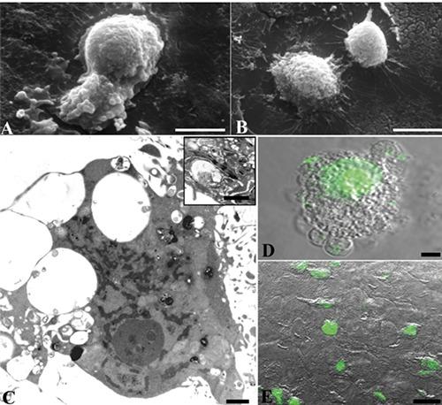 https://cdn.ncbi.nlm.nih.gov/pmc/blobs/23f7/5617901/b7a852932095/ejh-61-3-2784-g002.jpg