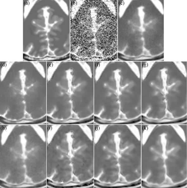 https://cdn.ncbi.nlm.nih.gov/pmc/blobs/23f9/4360923/05d926250658/12938_2014_935_Fig16_HTML.jpg