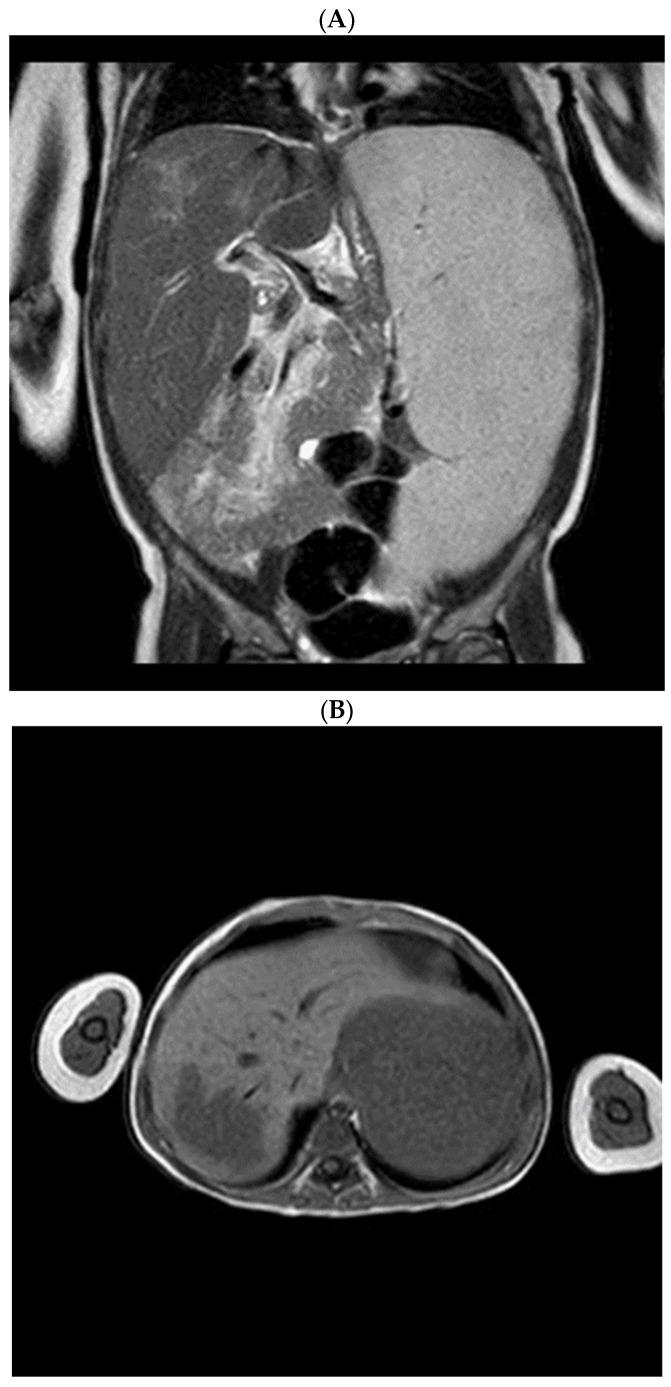 https://cdn.ncbi.nlm.nih.gov/pmc/blobs/23fc/10216919/62718229d798/children-10-00869-g001.jpg