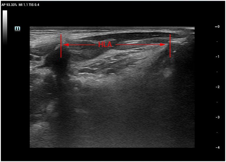 https://cdn.ncbi.nlm.nih.gov/pmc/blobs/23fe/12279852/456e3fdf52e3/fmed-12-1533165-g009.jpg