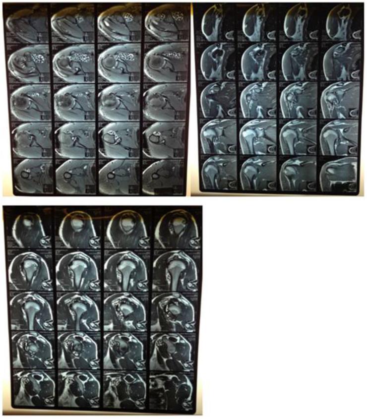 https://cdn.ncbi.nlm.nih.gov/pmc/blobs/23ff/6297053/cd0ec7703d30/gr3.jpg