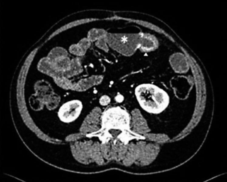 https://cdn.ncbi.nlm.nih.gov/pmc/blobs/240a/10050865/b36b9689b8fd/pjg-0030-0141-g01.jpg